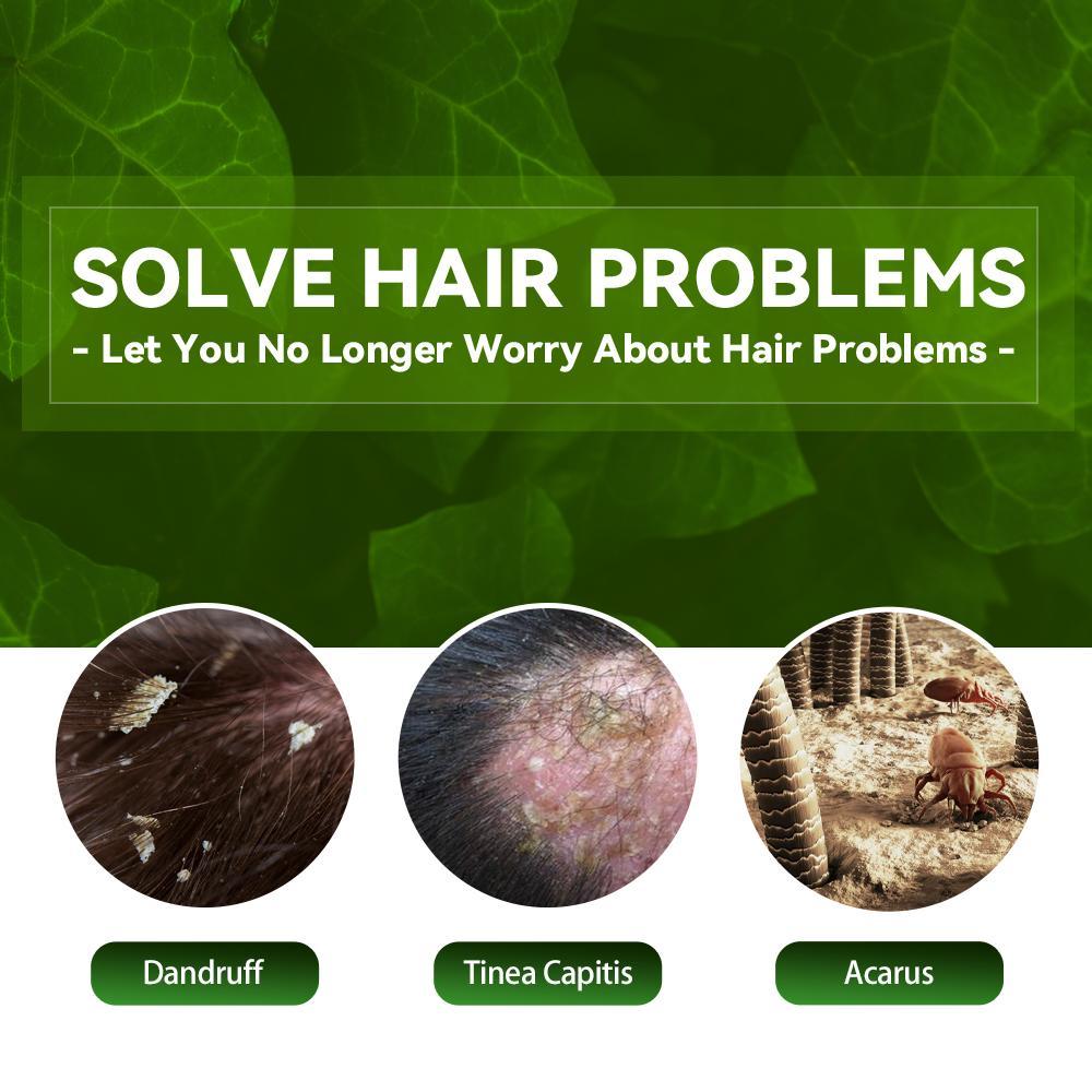 EELHOE Anti-Dandruff Shampoo - Itch Relief, Hair Loss Prevention, Oil Control & Refreshing Care by DC-THE CEO