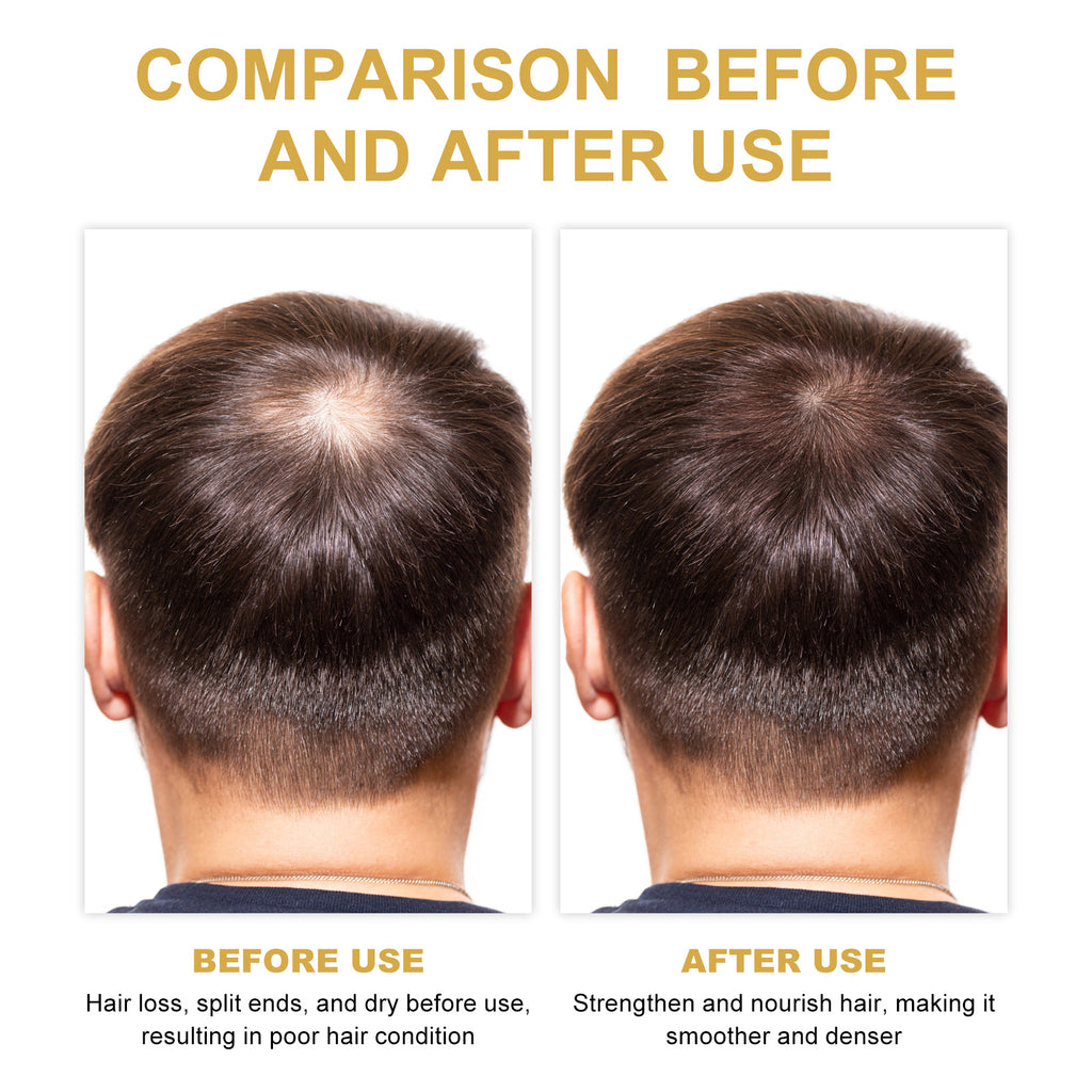 EELHOE Rosemary Hair Treatment Oil Scalp Cleansing Conditioning Volumizing Smoothing Repair Dry Frizzy Hair Conditioning Hair Treatment Oil by DC-THE CEO